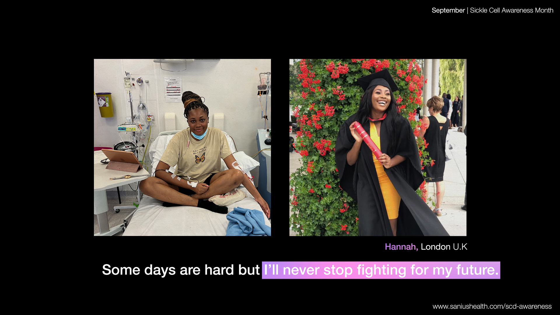 Burden of Illness Sickle Cell Disease